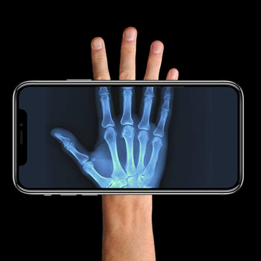 Xray Vision: Camera Filter Download on Windows