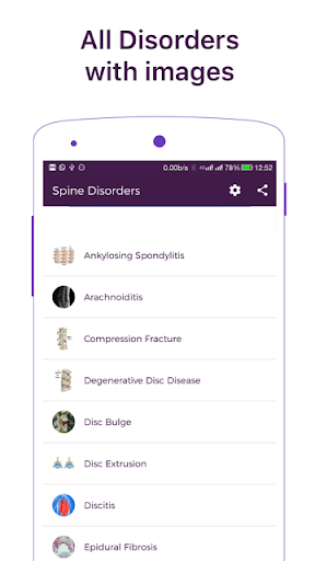 Spine Diseases and Treatment
