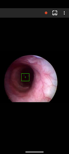 EndoSemio Screen 2
