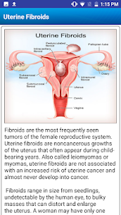 Uterine Fibroid Treatment Help MOD APK 2.1 (Pro Unlocked) 2
