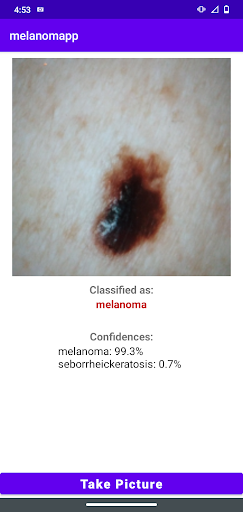 MelanomApp Screen 3