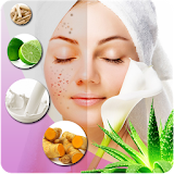 Pimple Remedies icon