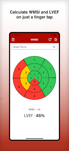 WMSI : Wall Motion Score Index Screen 2