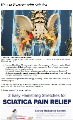 Android application How to Do Exercise fo Sciatica screenshort