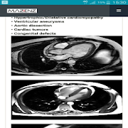 CardioMRI 1.2.1 Icon