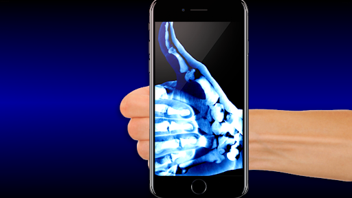 Roentgen xray photo editor