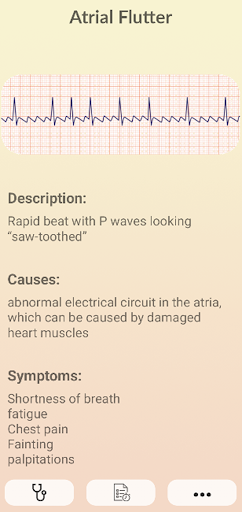 ECG Guide Screen 2