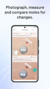 Miiskin Skin & Dermatology - Apps On Google Play