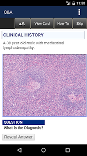 Anatomic Pathology Flashcards Ekran görüntüsü