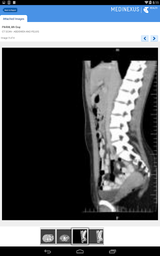 Medinexus Mobile for Patients Screenshot