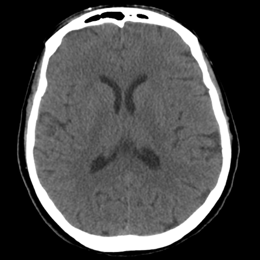 Brain CT : annotated slices logo