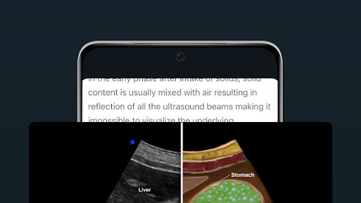 Point of Care Ultrasound Mod APK 1.0.3 (Unlocked) Gallery 4