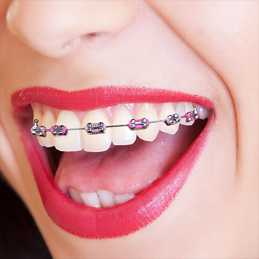 Braces Camera logo