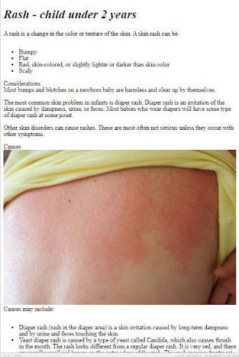 How to Treat Baby Rash Screen 3