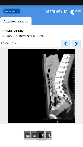 Medinexus Mobile for Patients Screenshot