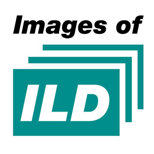 Images of ILD