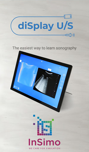 Android application diSplay U/S probe screenshort