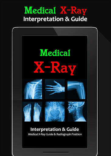 X-Ray Interpretation Guide