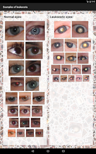 CRADLE White Eye Detector Screenshot