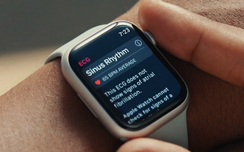 Sync Apple Watch Hint