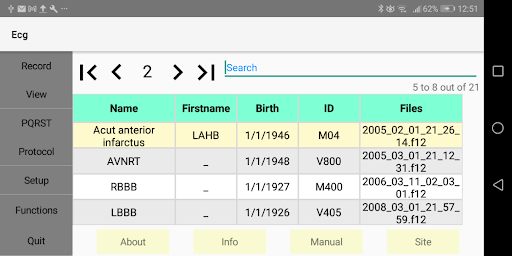 Android application Ecg screenshort
