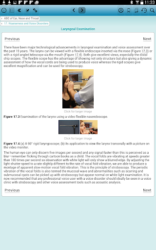 ABC of Ear, Nose and Throat 6e