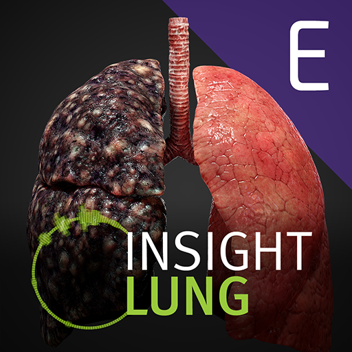 INSIGHT LUNG Enterprise Download on Windows