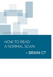 Normal Radiology: CT Brain