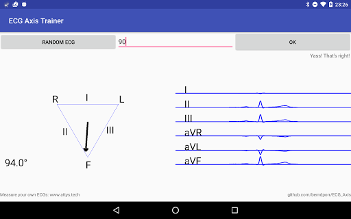 ECG Axis Trainer Screen 2