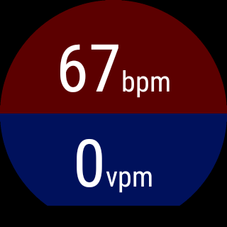 EMS Pulse Timer