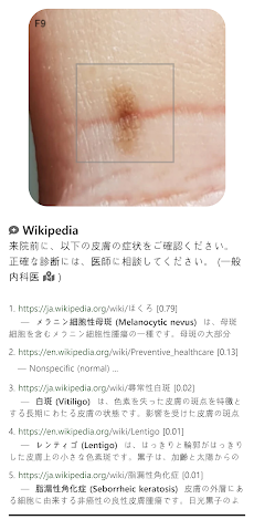 Model Dermatol – 皮膚疾患のおすすめ画像1