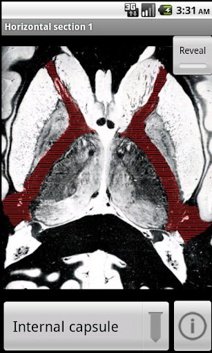 NeuroSlice Screen 2