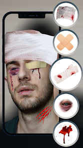 Imágen 9 Heridas En Fotos Reales android