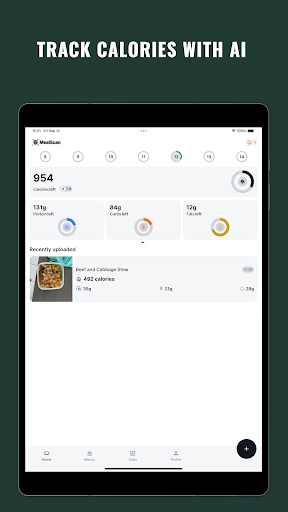 MealScan Food Calorie Tracker