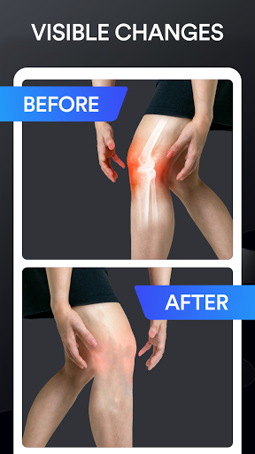 Android application Knee Pain Relief Yoga Therapy screenshort
