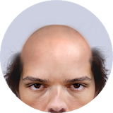 Bald Face icon