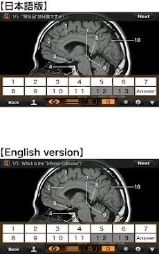 CT・MRI解体新書のおすすめ画像4