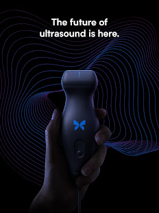 Butterfly iQ — Ultrasound