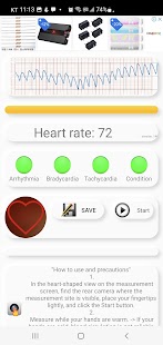Cardiac Diagnosis (Arrhythmie) Screenshot