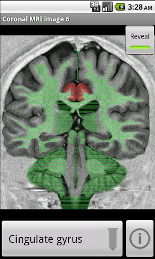 Android application NeuroSlice screenshort