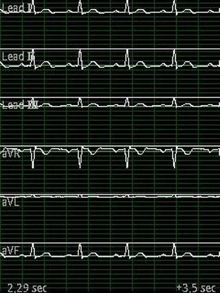Android application EDF Viewer screenshort
