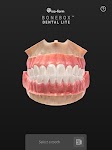screenshot of BoneBox™ - Dental Lite