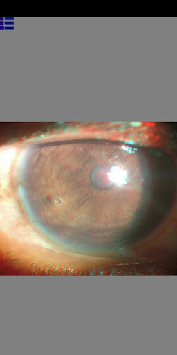 3D Atlas of Ophthalmology Screen 2