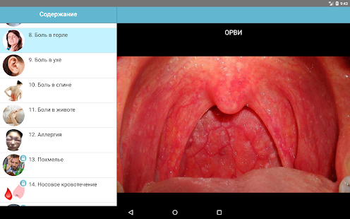 Скачать игру Первая помощь - Карманный доктор (базовая версия) для Android бесплатно