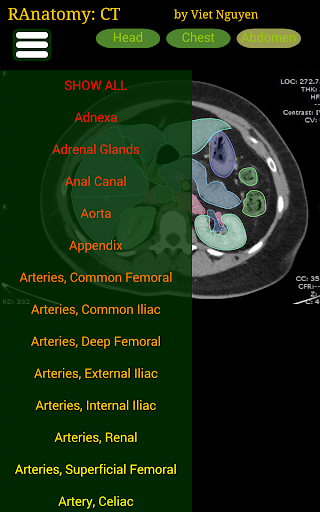 Radiology CT Anatomy 1.6 APK screenshots 4
