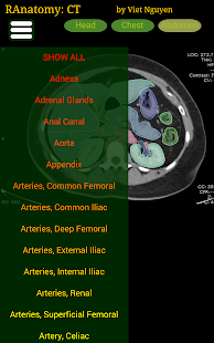 Radiology CT Anatomy 1.6 Screenshots 7