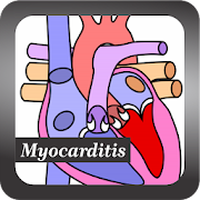 Recognize Myocarditis Disease  Icon