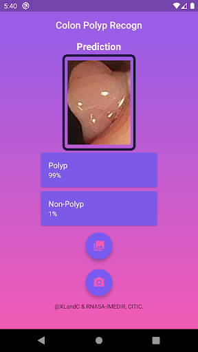 Colon Polyp Recogn Screen 3
