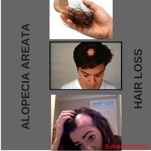 Alopecia / Hair Loss 1.0 Icon