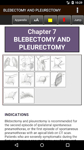 Atlas of Minimally Invasive Su Screen 3